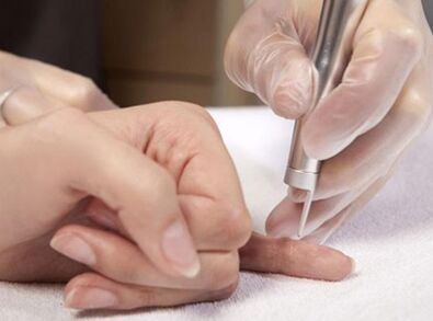 Effectuer une thérapie au laser.