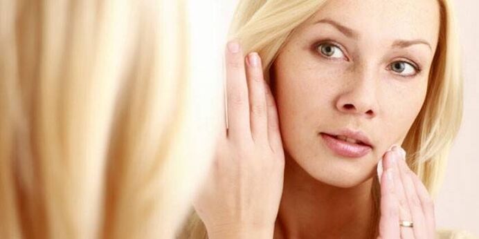 Manifestations du virus du papillome humain sur le visage.